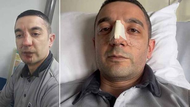 Bakırköy’de darp edilen güvenlik görevlisi: Hiçbir suçum yoktu